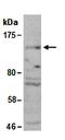 Histone Deacetylase 9 antibody, orb67059, Biorbyt, Western Blot image 