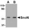 SKI Like Proto-Oncogene antibody, TA306034, Origene, Western Blot image 