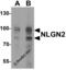 Neuroligin 2 antibody, 7969, ProSci, Western Blot image 