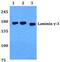 Laminin Subunit Gamma 3 antibody, PA5-37448, Invitrogen Antibodies, Western Blot image 