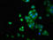 Leukocyte tyrosine kinase receptor antibody, LS-C670591, Lifespan Biosciences, Immunofluorescence image 