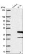Proto-oncogene serine/threonine-protein kinase mos antibody, PA5-59173, Invitrogen Antibodies, Western Blot image 