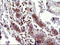 Secretory Carrier Membrane Protein 2 antibody, LS-C788396, Lifespan Biosciences, Immunohistochemistry paraffin image 