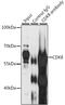 Cyclin Dependent Kinase 8 antibody, GTX33086, GeneTex, Immunoprecipitation image 