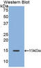 Platelet Derived Growth Factor Subunit A antibody, LS-C295951, Lifespan Biosciences, Western Blot image 