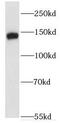 Erythrocyte Membrane Protein Band 4.1 Like 2 antibody, FNab02797, FineTest, Western Blot image 