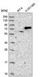 SUMO Specific Peptidase 1 antibody, HPA046491, Atlas Antibodies, Western Blot image 