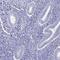 Acyl-CoA Synthetase Bubblegum Family Member 2 antibody, PA5-62292, Invitrogen Antibodies, Immunohistochemistry paraffin image 