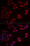 Natural Cytotoxicity Triggering Receptor 3 antibody, LS-C747710, Lifespan Biosciences, Immunofluorescence image 