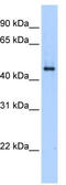 Plasminogen activator inhibitor 1 antibody, TA342382, Origene, Western Blot image 