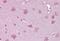Norrin Cystine Knot Growth Factor NDP antibody, NBP1-59305, Novus Biologicals, Immunohistochemistry paraffin image 
