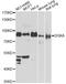 Diacylglycerol Kinase Alpha antibody, A13969, ABclonal Technology, Western Blot image 
