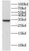 High Mobility Group Box 2 antibody, FNab03925, FineTest, Western Blot image 