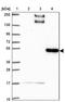 BEN Domain Containing 5 antibody, PA5-63507, Invitrogen Antibodies, Western Blot image 