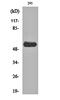 SRC Proto-Oncogene, Non-Receptor Tyrosine Kinase antibody, orb159666, Biorbyt, Western Blot image 
