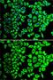 Succinate Dehydrogenase Complex Flavoprotein Subunit A antibody, GTX33490, GeneTex, Immunocytochemistry image 