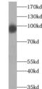 SLIT And NTRK Like Family Member 6 antibody, FNab07984, FineTest, Western Blot image 