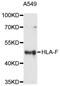HLA class I histocompatibility antigen, alpha chain F antibody, abx125951, Abbexa, Western Blot image 