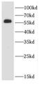 Calsequestrin-2 antibody, FNab01299, FineTest, Western Blot image 