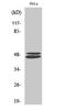 Vasodilator Stimulated Phosphoprotein antibody, STJ96219, St John
