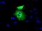 Peroxisomal targeting signal 1 receptor antibody, GTX83908, GeneTex, Immunocytochemistry image 