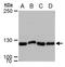 ERCC Excision Repair 4, Endonuclease Catalytic Subunit antibody, PA5-77973, Invitrogen Antibodies, Western Blot image 