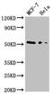 Nuclear receptor subfamily 0 group B member 1 antibody, LS-C678856, Lifespan Biosciences, Western Blot image 