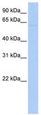 Leucine Rich Repeat Containing 56 antibody, TA337606, Origene, Western Blot image 