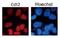 Denticleless E3 Ubiquitin Protein Ligase Homolog antibody, GTX00893, GeneTex, Immunofluorescence image 