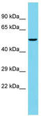 Family With Sequence Similarity 222 Member B antibody, TA330691, Origene, Western Blot image 