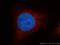 Stp antibody, 10911-2-AP, Proteintech Group, Immunofluorescence image 