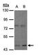 Opioid Receptor Mu 1 antibody, GTX108125, GeneTex, Western Blot image 