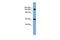 Electrogenic sodium bicarbonate cotransporter 4 antibody, GTX46799, GeneTex, Western Blot image 