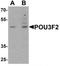 POU domain, class 3, transcription factor 2 antibody, TA319696, Origene, Western Blot image 