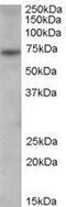PADI4 antibody, GTX89631, GeneTex, Western Blot image 