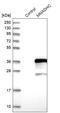 Methylmalonic aciduria and homocystinuria type D protein, mitochondrial antibody, HPA037532, Atlas Antibodies, Western Blot image 