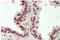 Homeobox D13 antibody, AP33006PU-N, Origene, Immunohistochemistry paraffin image 