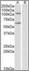 Iron Responsive Element Binding Protein 2 antibody, orb89665, Biorbyt, Western Blot image 