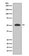 Phosphatidylinositol 3-kinase regulatory subunit gamma antibody, M06707, Boster Biological Technology, Western Blot image 