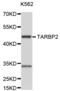 TARBP2 Subunit Of RISC Loading Complex antibody, abx004677, Abbexa, Western Blot image 