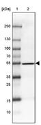 Coiled-Coil Domain Containing 173 antibody, PA5-60192, Invitrogen Antibodies, Western Blot image 