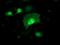 Alcohol Dehydrogenase 1B (Class I), Beta Polypeptide antibody, MA5-25524, Invitrogen Antibodies, Immunocytochemistry image 