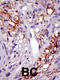 Ubiquitin carboxyl-terminal hydrolase 22 antibody, GTX02528, GeneTex, Immunohistochemistry paraffin image 