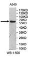 UDP Glucuronosyltransferase Family 2 Member A3 antibody, abx037322, Abbexa, Enzyme Linked Immunosorbent Assay image 