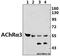 Neuronal acetylcholine receptor subunit alpha-3 antibody, GTX66702, GeneTex, Western Blot image 