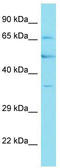 F-Box Protein 46 antibody, TA337309, Origene, Western Blot image 