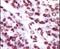 Protein Kinase C Epsilon antibody, PA5-13745, Invitrogen Antibodies, Immunohistochemistry frozen image 