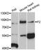 Coagulation Factor II, Thrombin antibody, abx125833, Abbexa, Western Blot image 
