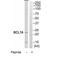 B-cell CLL/lymphoma 7 protein family member A antibody, TA313240, Origene, Western Blot image 