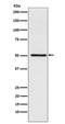 Cytochrome P450 Family 17 Subfamily A Member 1 antibody, M00615-1, Boster Biological Technology, Western Blot image 